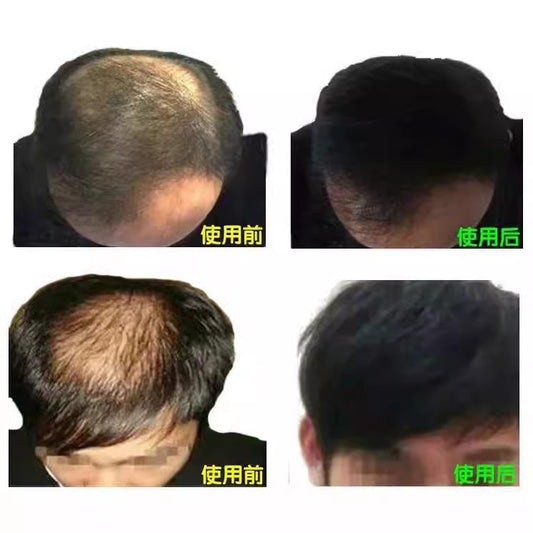DEXE Fiber  Hair Treasure