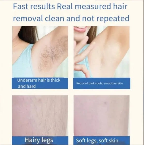 IPL Seduction Hair Remover™